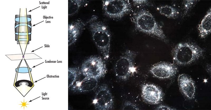 What can you see in dark field microscopy