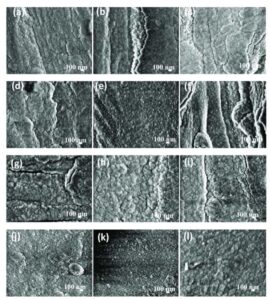 Transmission Electron Microscope vs Scanning Electron Microscope ...