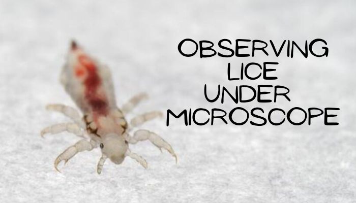 Observing Lice Under Microscope guide