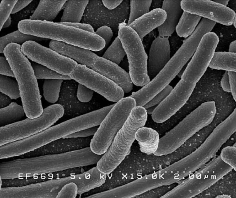 What Do Bacteria Look Like Under a Microscope? » Microscope Club