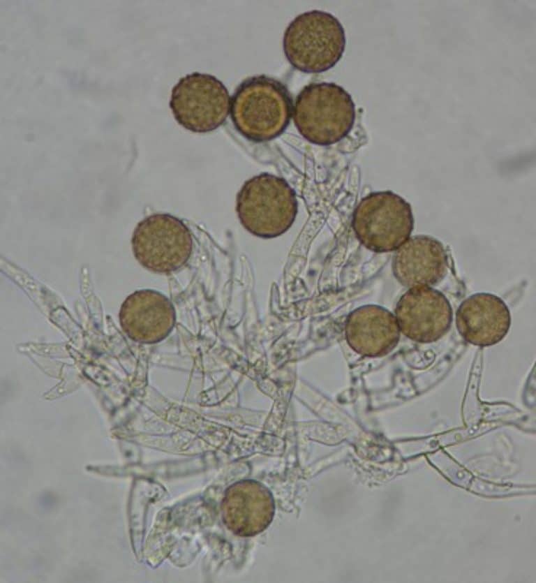 Mold Shape Microscope Mould Under a Microscope: What You'll See » Microscope Club