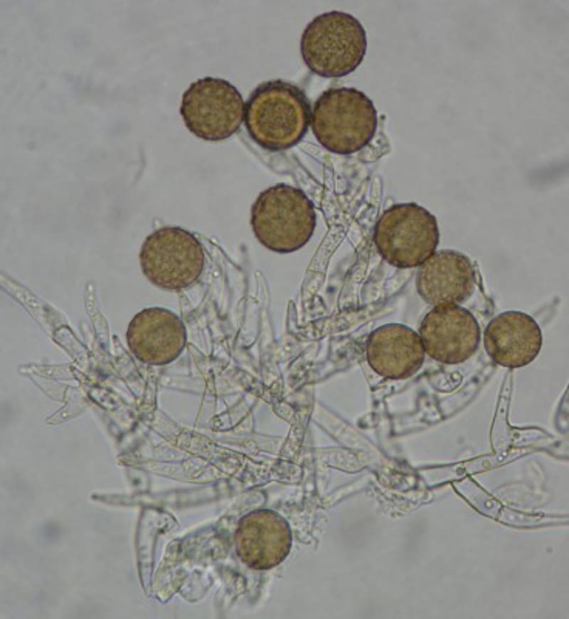 Hyphae and mycelium of common household mould viewed under a compound microscope
