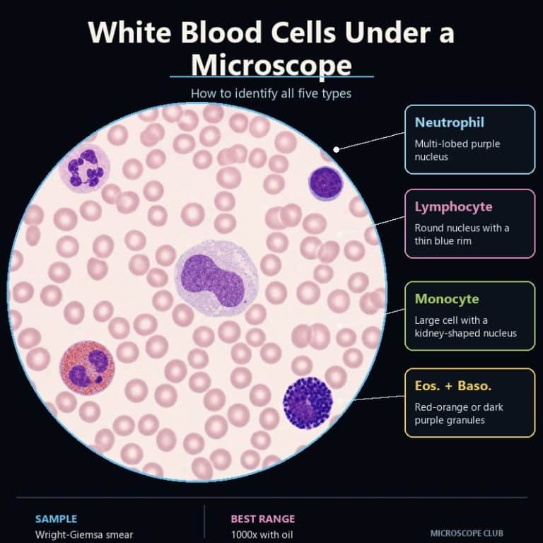 Five white blood cell types in a stained smear: neutrophil, lymphocyte, monocyte, eosinophil and basophil