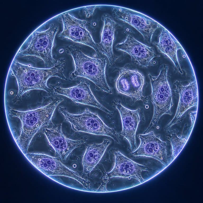 Adherent HeLa cells with prominent nuclei and one dividing cell in a phase-contrast field