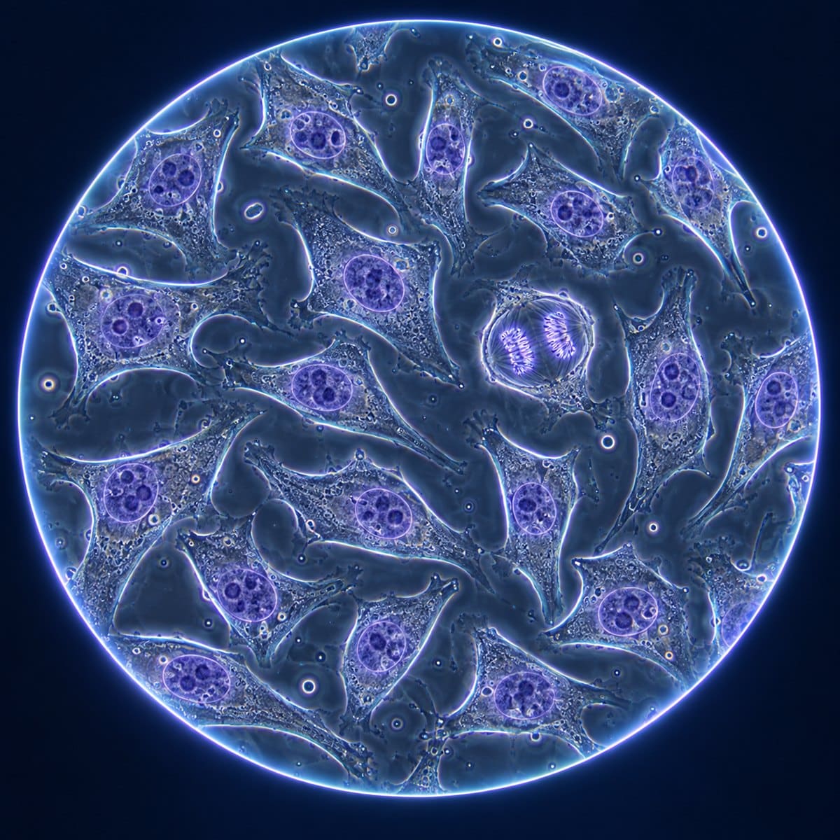 Adherent HeLa cells with prominent nuclei and one dividing cell in a phase-contrast field